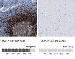 TCL1 / T-cell leukemia/lymphoma 1A.jpg